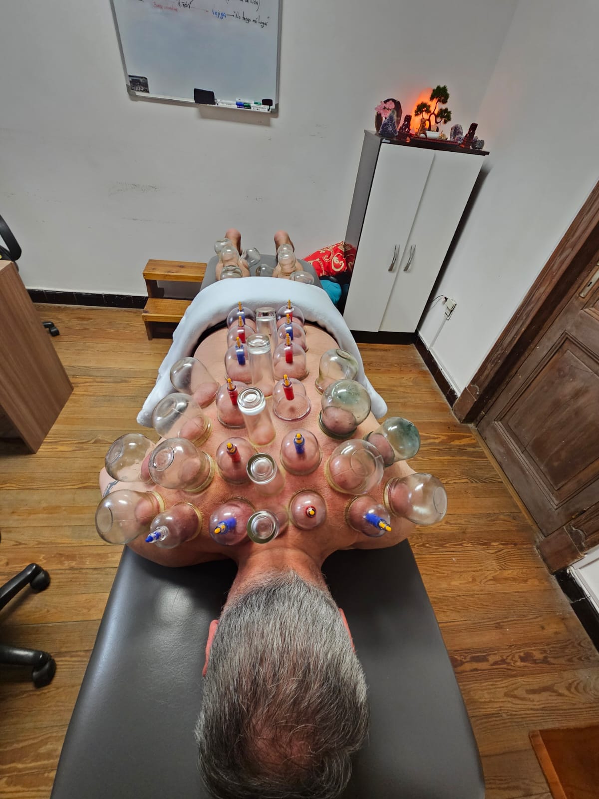 Tratamiento con ventosas